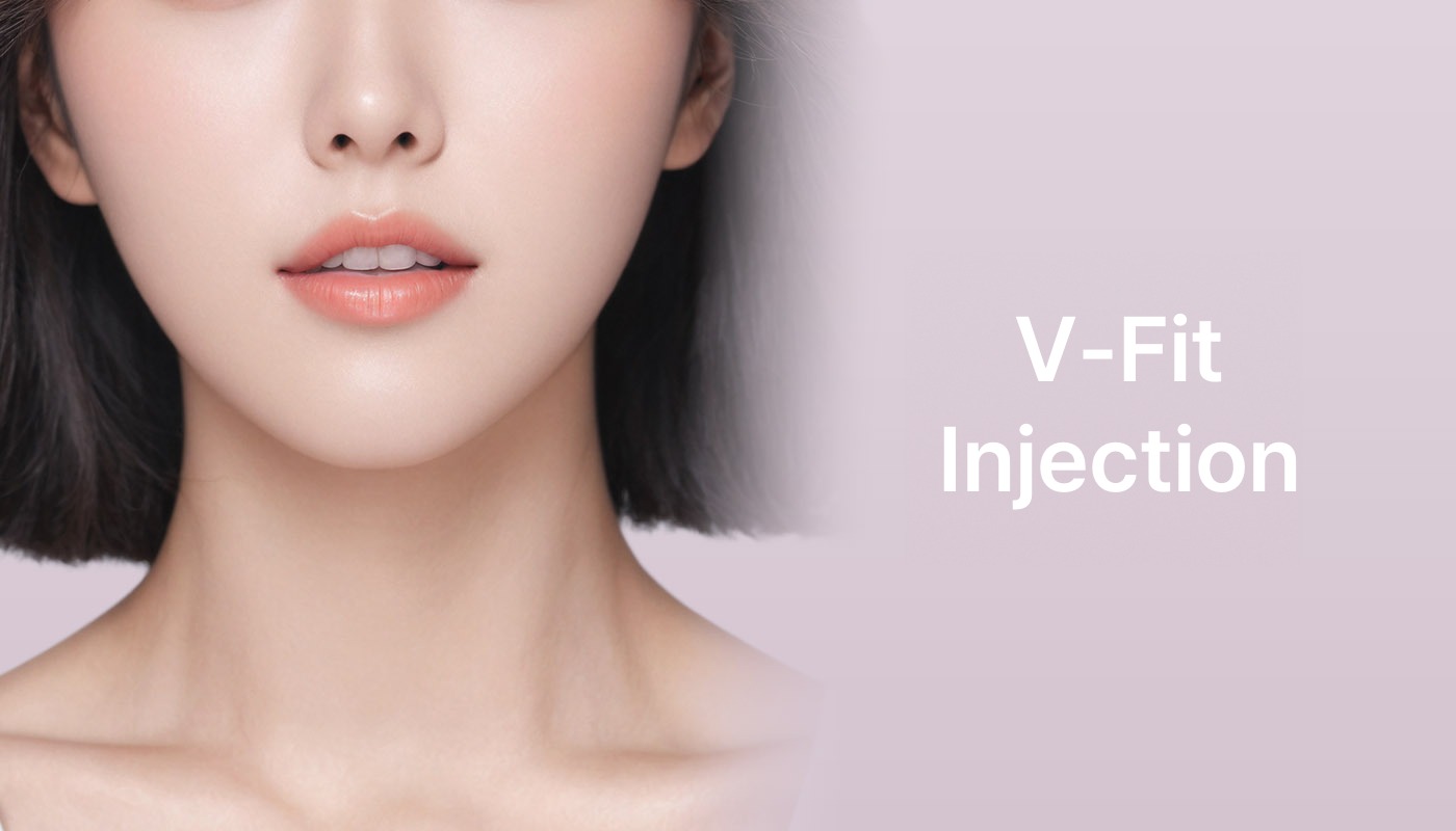 V-Fit Injection