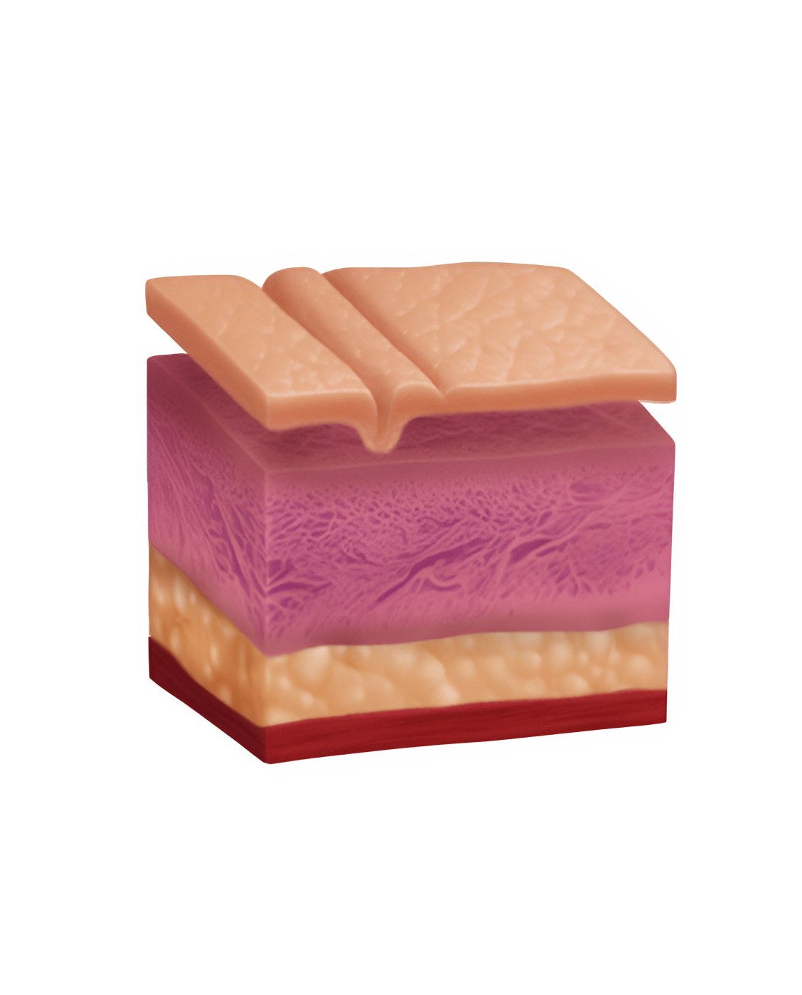 Belotero official illustration, Beauty Z Skin Clinic Myeongdong